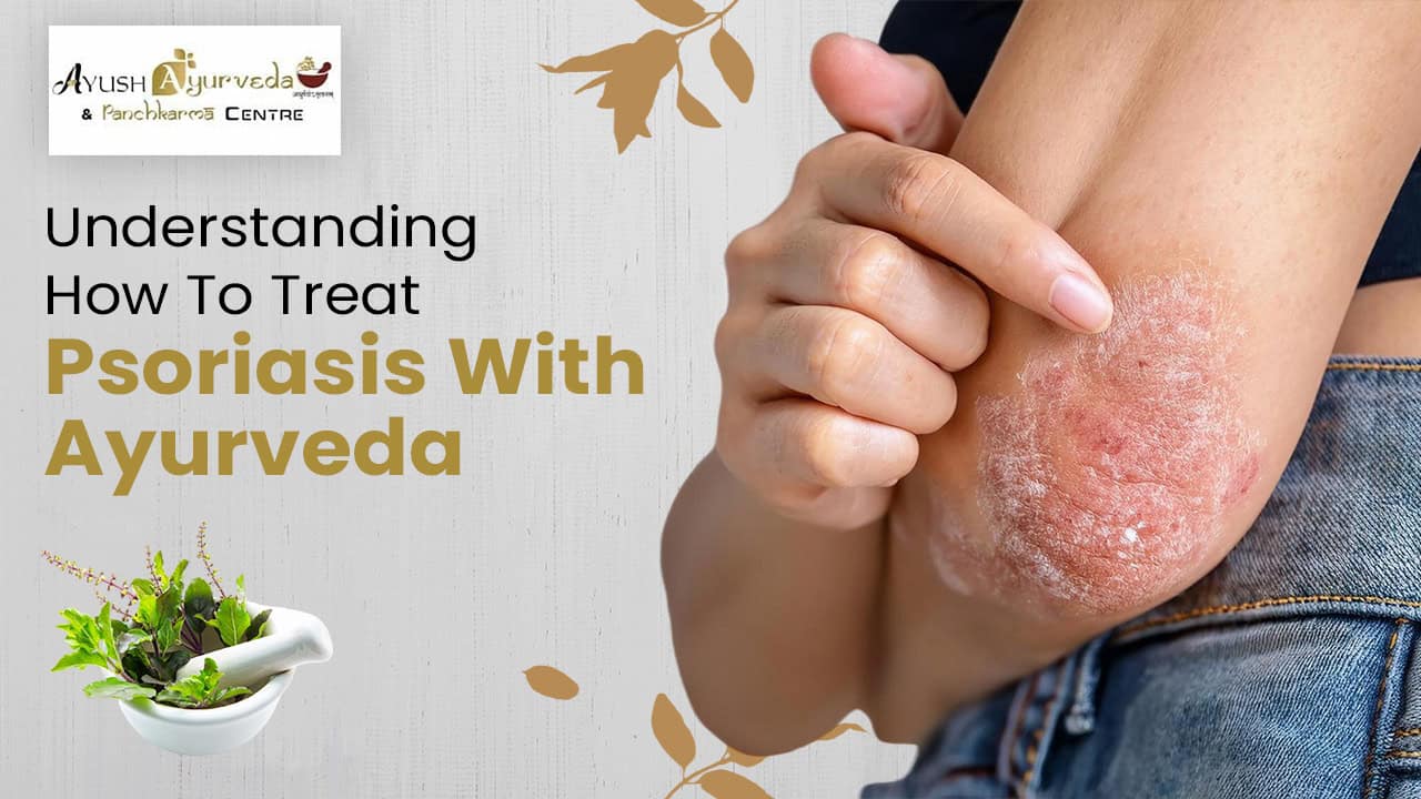 Understanding How To Treat Psoriasis With Ayurveda